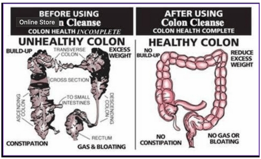 How To CLEANSE Up To 20 Lbs Of TOXIC WASTE